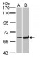 GPI Antibody